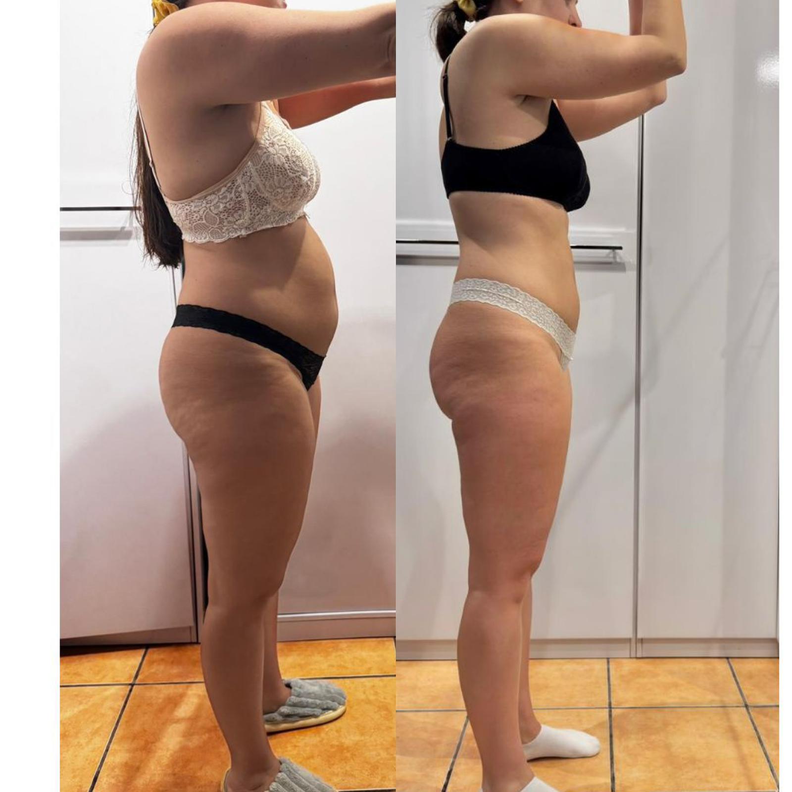Ana V. postparto bebé 4 meses