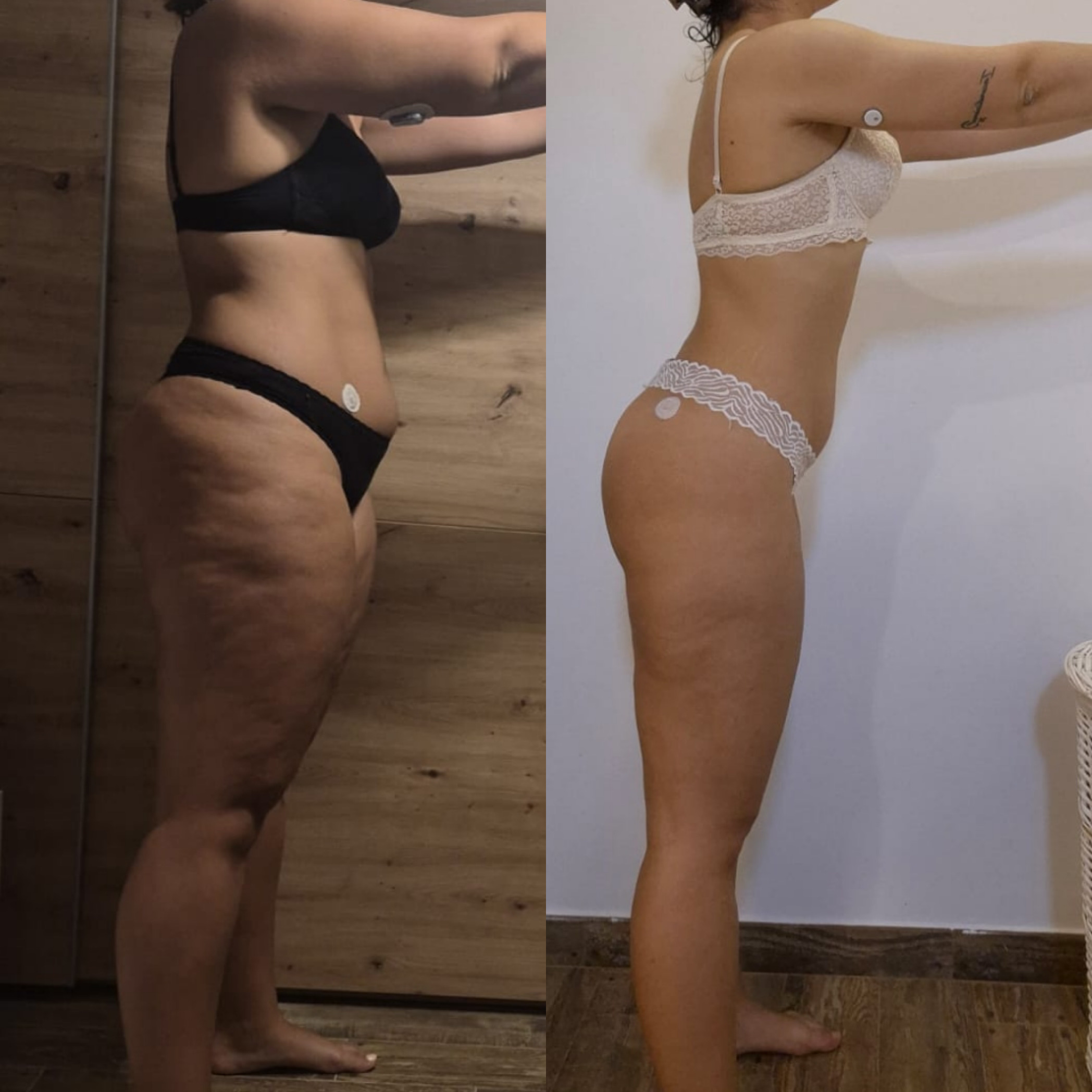 Melani L. transformación con diabetes