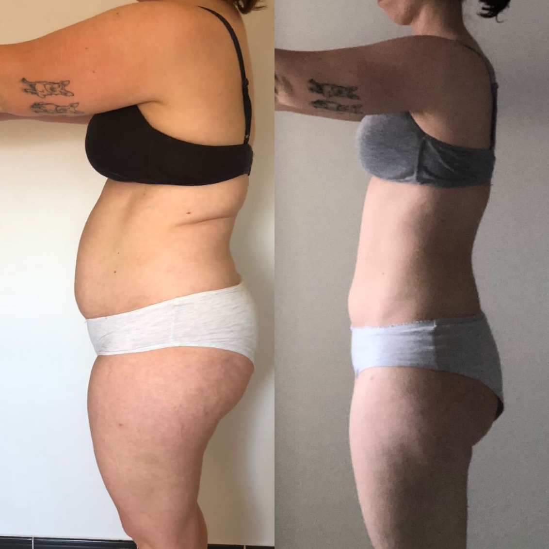Tania abdomen plano postparto 9 meses