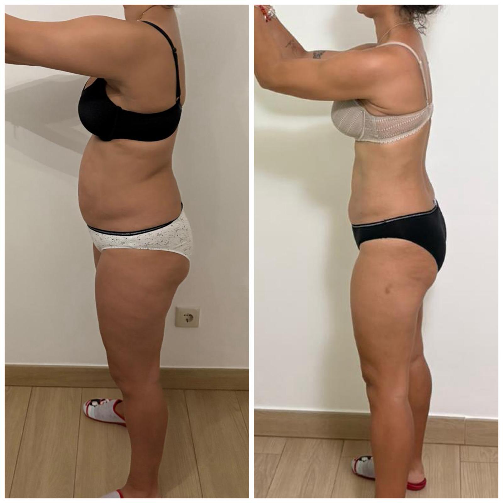 Victoria nutrición durante embarazo